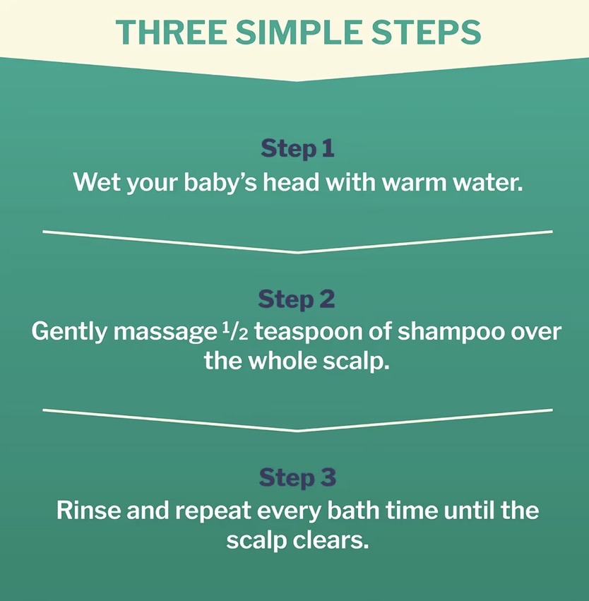 Dentinox Cradle Cap Treatment Shampoo 125ml